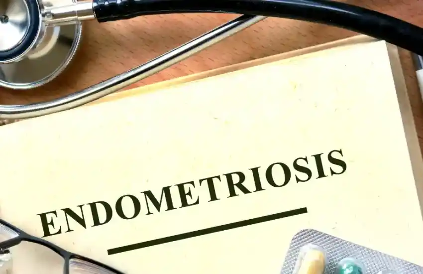 Quem tem endometriose pode se aposentar